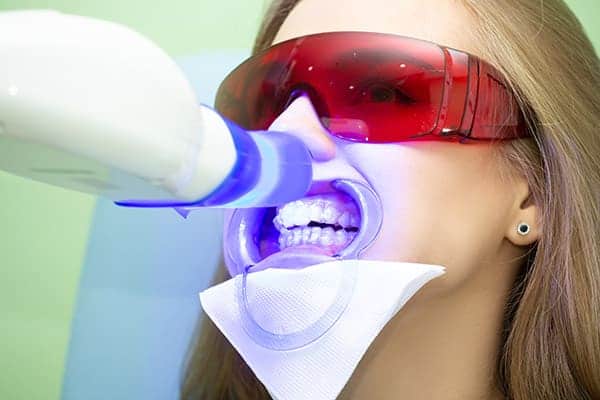 Laser teeth whitening treatments Northampton