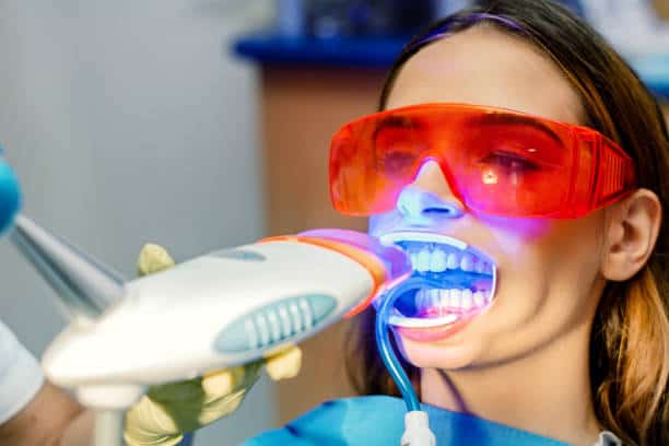 Simplifying Teeth Whitening: A Comprehensive Guide Northampton