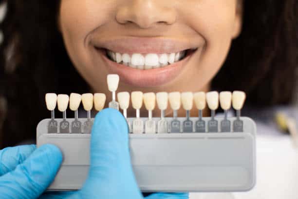 Laser Teeth Whitening: Exploring the Longevity of Your Brighter Smile Northampton