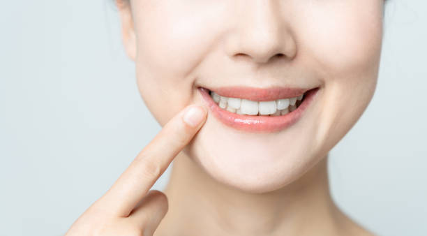 Comparing the Pain Factor: Laser Teeth Whitening vs. Zoom Teeth Whitening Northampton