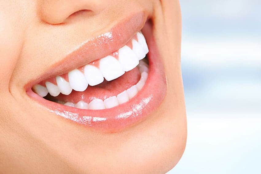 Teeth Whitening Abingdon Northampton