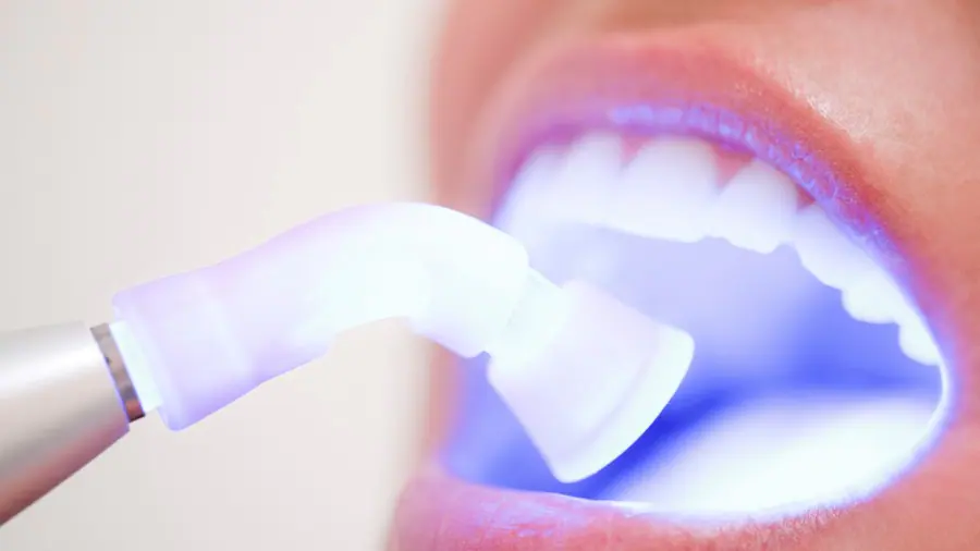 Teeth Whitening Aylesbury Northampton